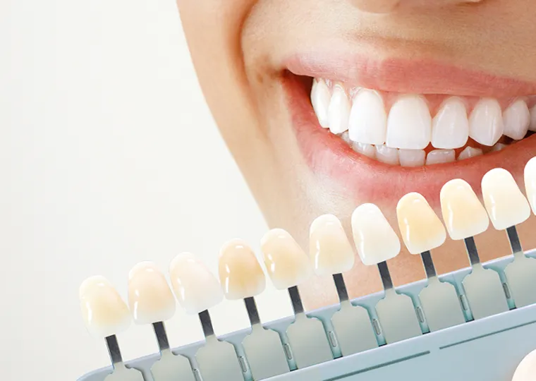 ホワイトニング