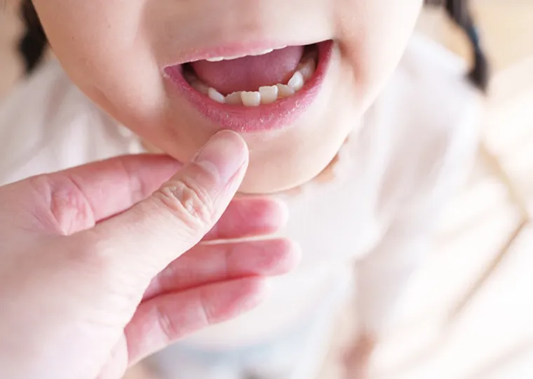 治療の開始時期について