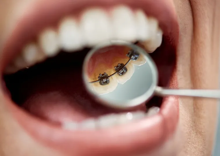 装置が見えない