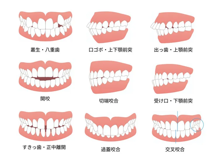 幅広い症例に対応可能