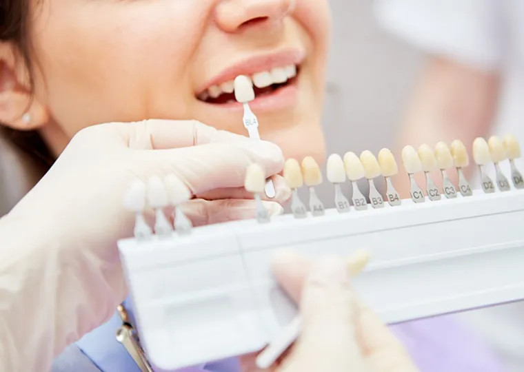 矯正中もホワイトニングOK