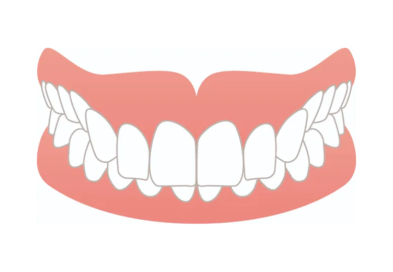 噛み合わせが深い