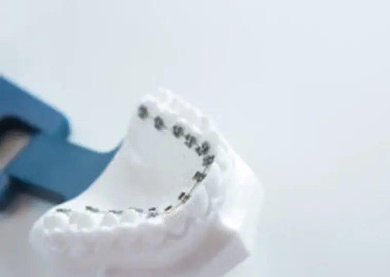 フルリンガル(舌側矯正)