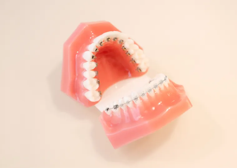 ハーフリンガル矯正