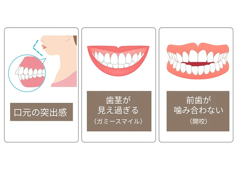 効率よく歯が動かせるからなりたい理想にアプローチできる