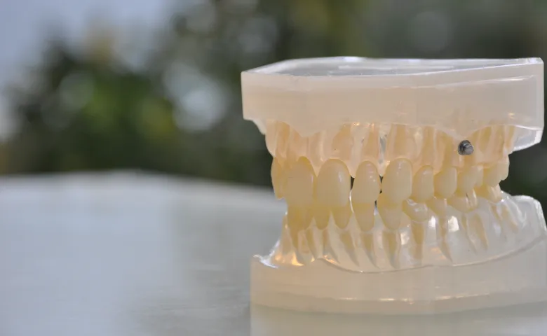 アンカースクリュー