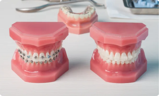 一人ひとりに合わせた歯列矯正法を提供