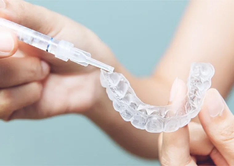 ホームホワイトニング