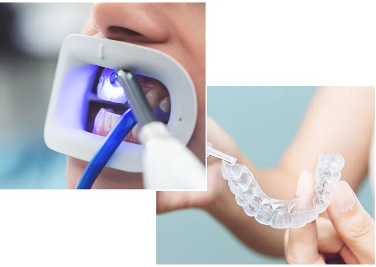 デュアルホワイトニング