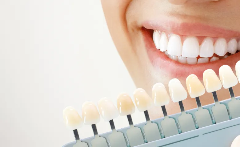 ホワイトニング