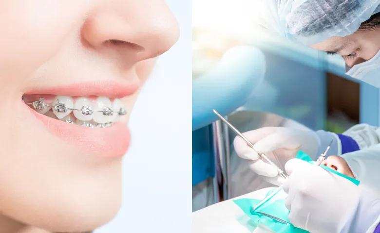 外科矯正｜神戸三宮そう矯正歯科｜顎口腔機能診断施設